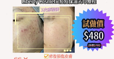 美容護膚前後對比廣告圖片